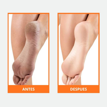 PediClinic+ Removedor de callos Profesional